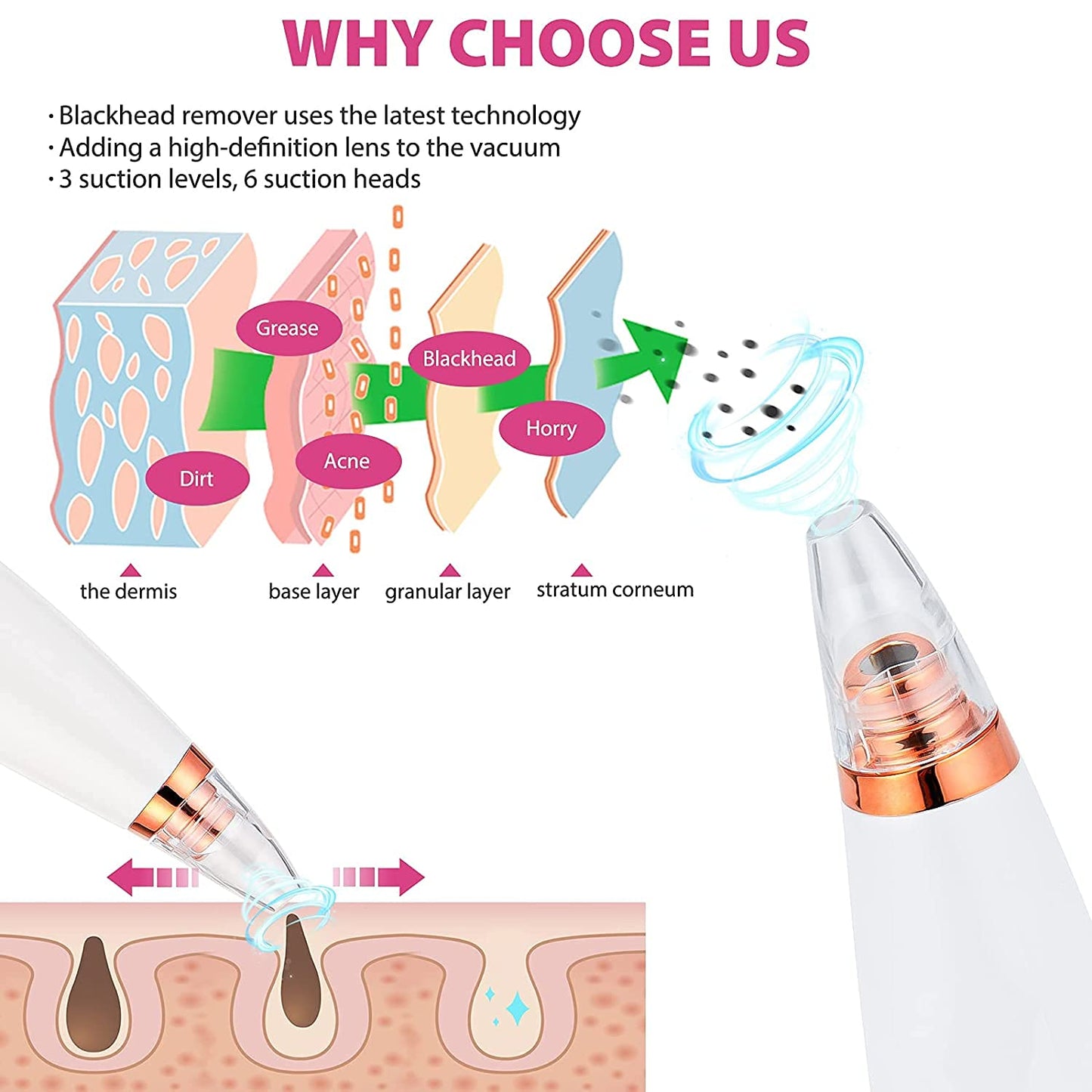 6 in 1 Blackhead Remover
